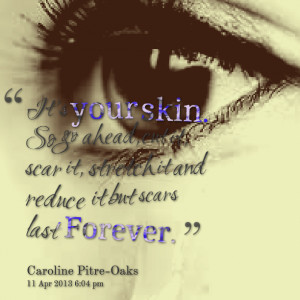 Scars From Cutting Quotes Quotes picture: it's your skin