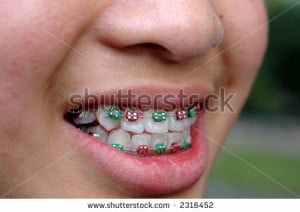 Christmas Colored Braces Smile with braces