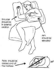 Spinal Cord Injury Bed Positioning Handouts
