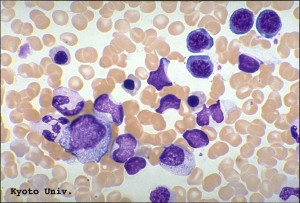 Normal Bone marrow smear, May-Giemsa stain, x1000