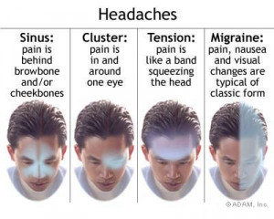 cluster headache migraine headache
