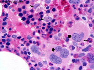 bone marrow histology