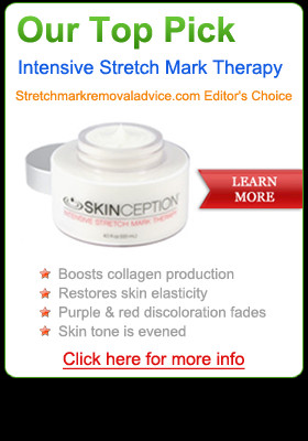 Stretch Mark Removal Cream