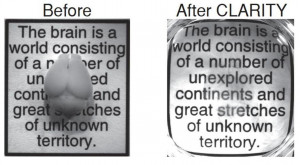 Intact adult mouse brain before and after the CLARITY process. The ...