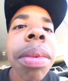 Dude’s lips are massive, and apparently even bigger in person.