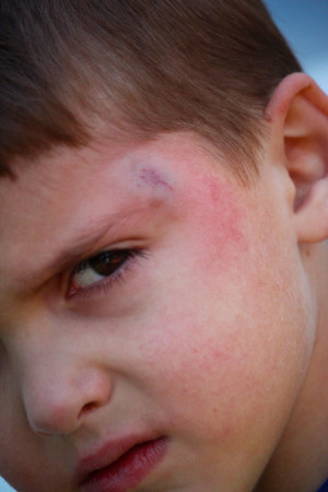 Accident Prone Quotes He's so accident prone.