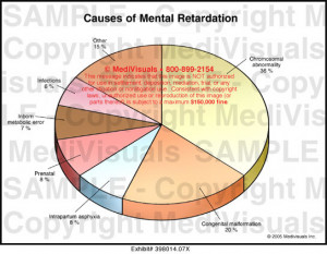 Causes of Mental Retardation - 398014.07X