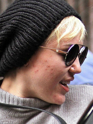 It happens to everyone: MIley Cyrus was seen leaving a skincare clinic ...