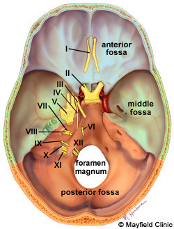 Figure 3A. The posterior fossa (orange color) is formed by the ...
