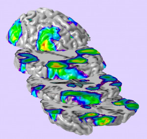fMRI Scan of Working Memory Activation in Typically-Developing ...