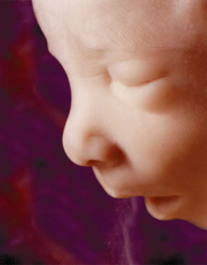 Abortionist Crushes the Skull Of a 17 Week-Old Unborn Baby (Slate Oct ...