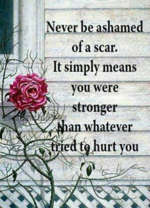 Never be ashamed of scars
