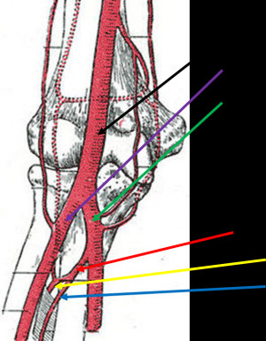 Posterior Interosseous Artery and Common