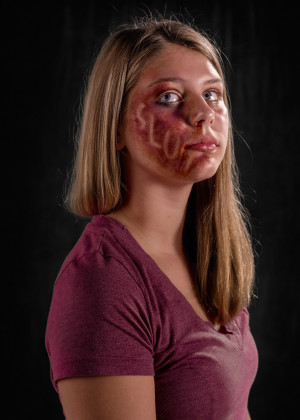 ... Photographer Captures the Invisible Pain of Verbal Abuse (NSFW