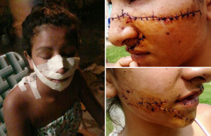 ... girls slashed her face with knives because she was ‘too pretty