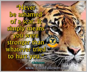 Never be ashamed of a scar. It simply means you were stronger than ...