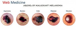 Abcd Of Melanoma Detection