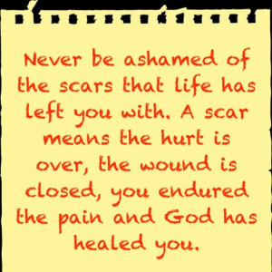 Never be ashamed of the scars that life has left you with. A scar ...