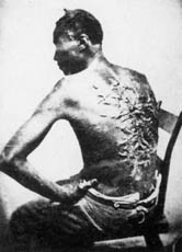 Dieses Bild zeigt einen misshandelten Sklaven, Louisiana (USA) 1863