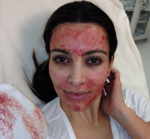 Weird Beauty: Kim Kardashian's Vampire Facial