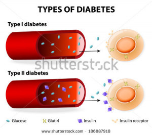 ... results into high blood sugar that leads to the buildup of substances