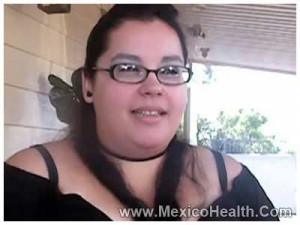 Victoria Ramos of California opted to go for gastric sleeve in Tijuana ...