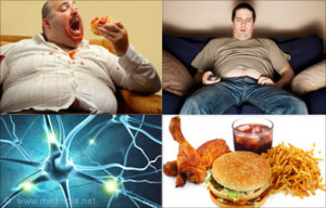 Common Causes of Obesity
