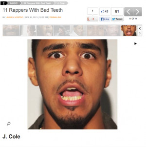 Cole told Fuse how people started mentioning his bad teeth after he ...