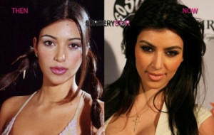 before plastic surgery - funny pictures - funny photos - funny ...