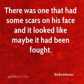Scars Quotes