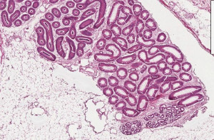 More resources about bcg equine sarcoids :