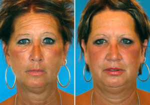 What 7 Smoker Vs. Non-Smoker Identical Twins Look Like After Years of ...