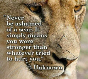 ... and family saw me deathly sick i am proud of my scars cause i survived