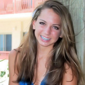 Cute Blue Braces More