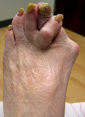 ugly feet
