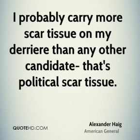 Haig - I probably carry more scar tissue on my derriere than any other ...