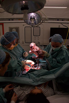 team of obstetricians performing a Caesarean section in a modern ...