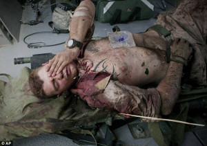 War wounds: Cpl Britt and two other Marines were hit by shrapnel in an ...
