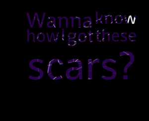 Quotes Picture: wanna know how i got these scars?
