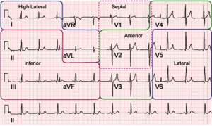 ECG Image With Regions Of The Heart Highlighted