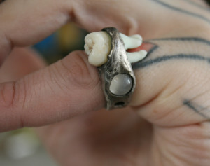 wisdom tooth ring 1-t