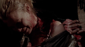 Andrea, showing her bite before suicide.