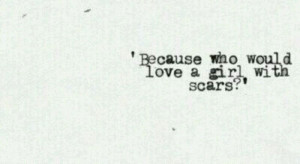 Vic Fuentes Self Harm Scars Tumblr #selfharm #depression #cuts