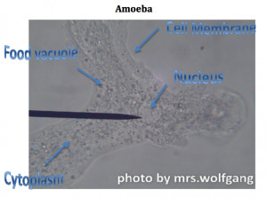 Amoeba Under Microscope Labeled