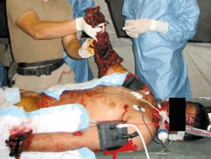 ... should these folks have to wait around for your god to get on with it