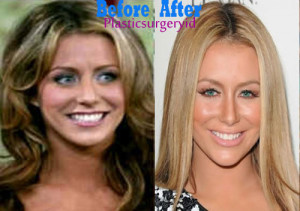 Aubrey-O-Day-Plastic-Surgery-Before-and-After.jpg