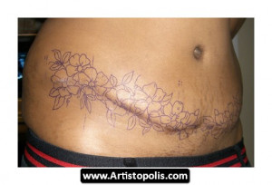 ... %20Marks%20Pictures%2005 Tattoos Covering Stretch Marks Pictures 05