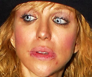 10 Worst Celebrity Lip Injections: Before And After Botched