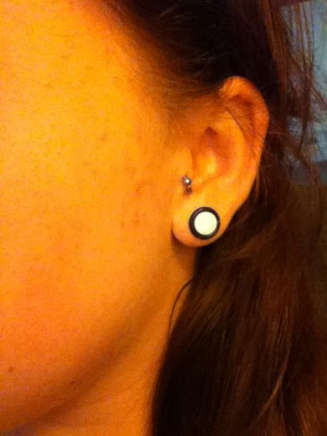 Thread blood blister