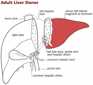 Pediatric Living-Related Liver Transplantation